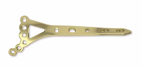 Запирающая пластина бедренной кости Титановые медицинские пластины Хирургические имплантаты, Запирающая пластина, Медицинское оборудование